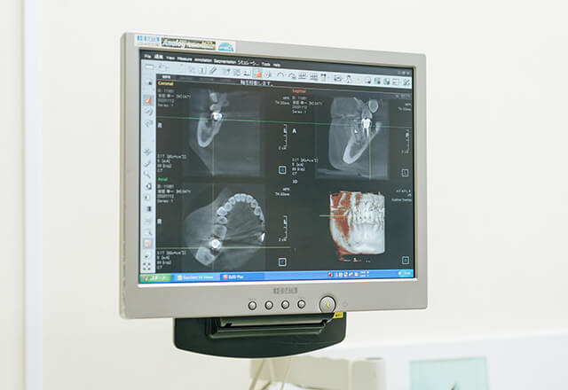 歯科用CTによる正確な診査診断